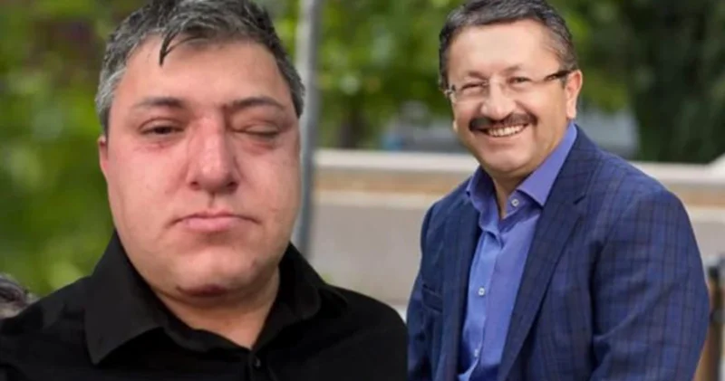 Altındağ Belediyesi nde dayak timi : Yedi yıl arayla gerçekleşen iki saldırıda aynı çalışanların olduğu tespit edildi!