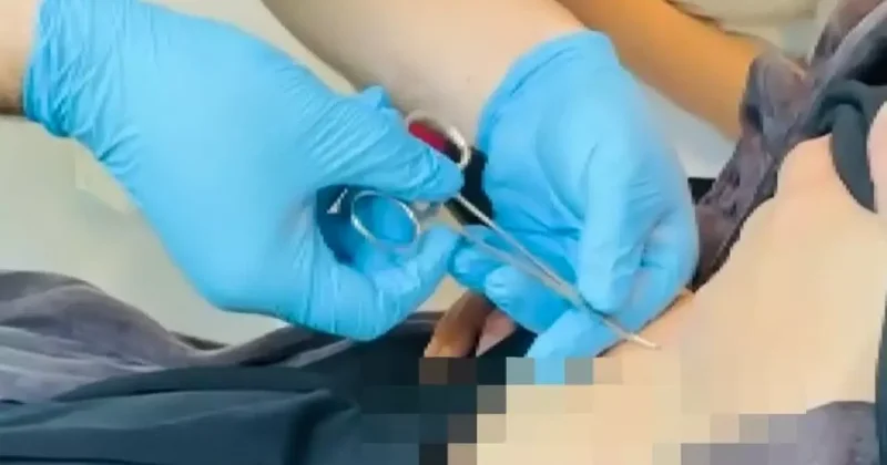 Halsizlik şikayetiyle doktora gitti, karnına yapışanı öğrenince şoke oldu