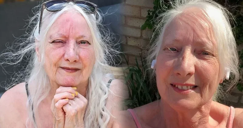 10 dakikalık uyku hayatını değiştirdi: Gözünü açamayacak hale geldi Sözcü Gazetesi