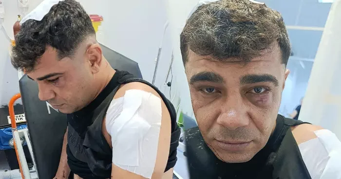İş görüşmesi için gitti, ölümden döndü! Olay yerinde hayatımı kaybedebilirdim