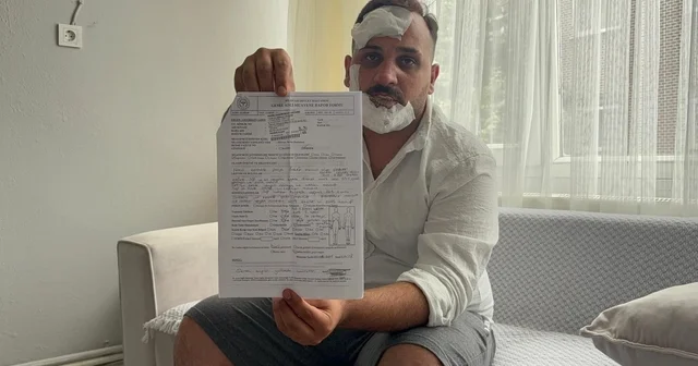 Taksici, eski sözlüsü ve ikizinin polis sevgililerinin kendisini dövdüğünü iddia etti Kocaeli Haberleri