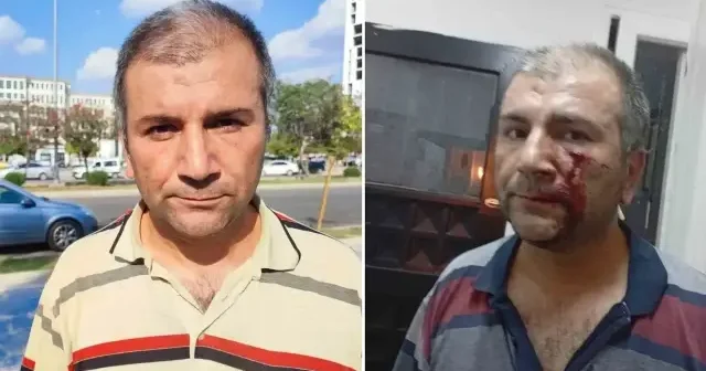 ’Kenara çekilir misiniz’ diyerek uyardı dayak yedi: Bana bir şey olursa ölümümden Conolar sorumludur Adana Haberleri