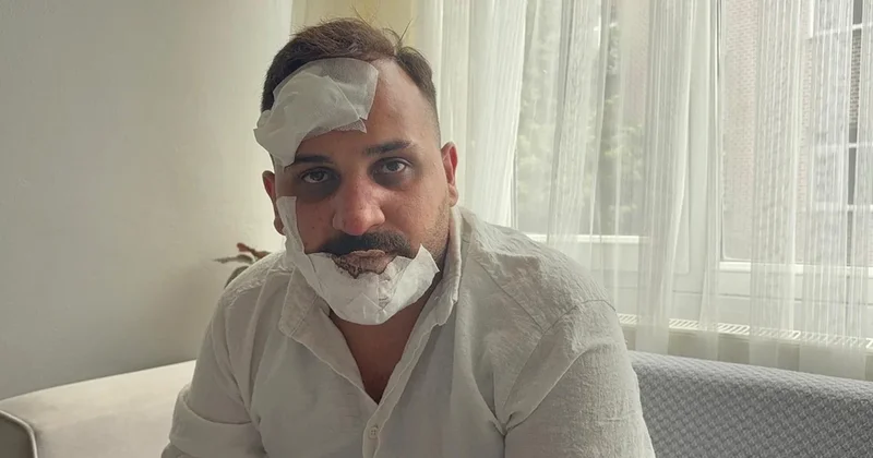 Eski sözlüye, polislerden öldüresiye dayak: Sülaleni öldürürüz Sözcü Gazetesi