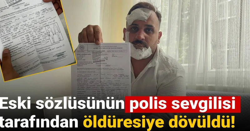Eski sözlüsünün polis sevgilisi tarafından öldüresiye dövüldü!