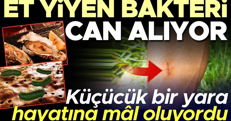 Sinsi tehlike: Et yiyen bakteri can alıyor, vaka sayıları arttı! Küçük bir çizik neredeyse hayatına mâl olacaktı