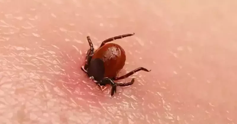 Bolu da kenenin ısırdığı kadın öldü