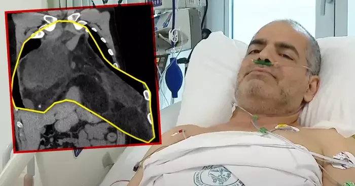 Türkiye’de bilinen ilk vaka! Ne doktorlar inanabildi ne de kendisi: ‘Şok geçirdim’
