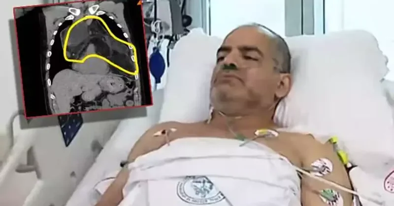 Meyve seçerken bir anda nefesi kesildi, hastalığını duyunca şoke oldu! Türkiye de bilinen ilk vaka!