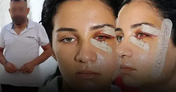 Adana haberleri Eski kocası tarafından darbedilen Ganime, yaşadığı dehşeti anlattı 03 Eylül 2025