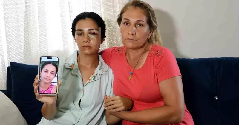 Eski Eş Şiddeti: Kadın Hastaneye Götürüldü
