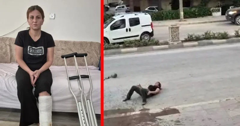 Konya da öldüresiye dövülen Dudu Gez Çat vahşeti SABAH a anlattı! Meğer bu ilk değilmiş...