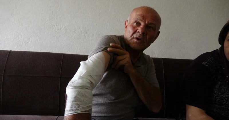 Burdur da beslemek istediği köpeğin saldırdığı taksici yaralandı