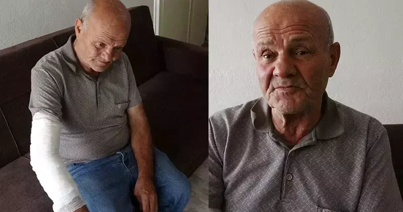 Kolunu ısıran köpeğe mama bırakıp, hastaneye giden taksici: Hayvan sevgimden vazgeçmem