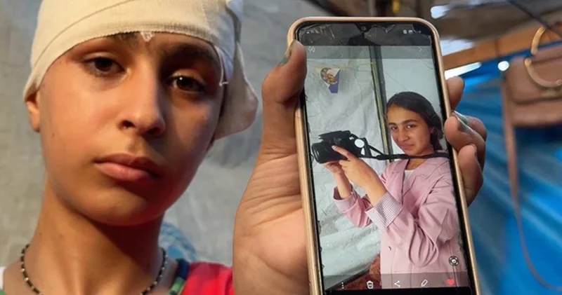 Gazze de 42 bin kişi “hayat değiştiren” yaralanmaya maruz kaldı