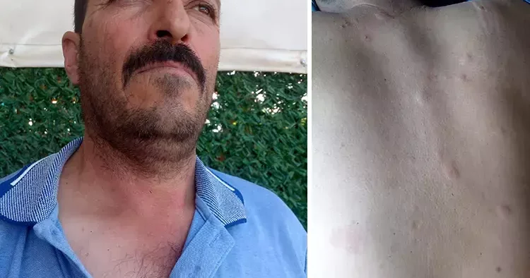 Duyduğu seslere giden çiftçi hayatının şokunu yaşadı! Ayı saldırısından kurtuldum derken dehşeti yaşadı