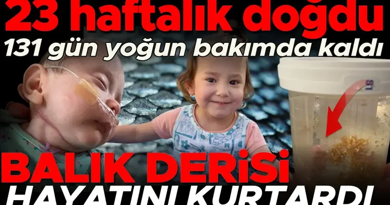 Prematüre doğdu, 131 gün yoğun bakımda kaldı. Hayatını balık derisi tedavisi kurtardı Ona küçük denizkızım diyorum