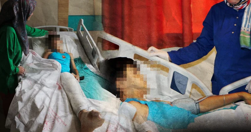 Akılalmaz olay! Şaka olsun diye arkadaşını ateşe verdi