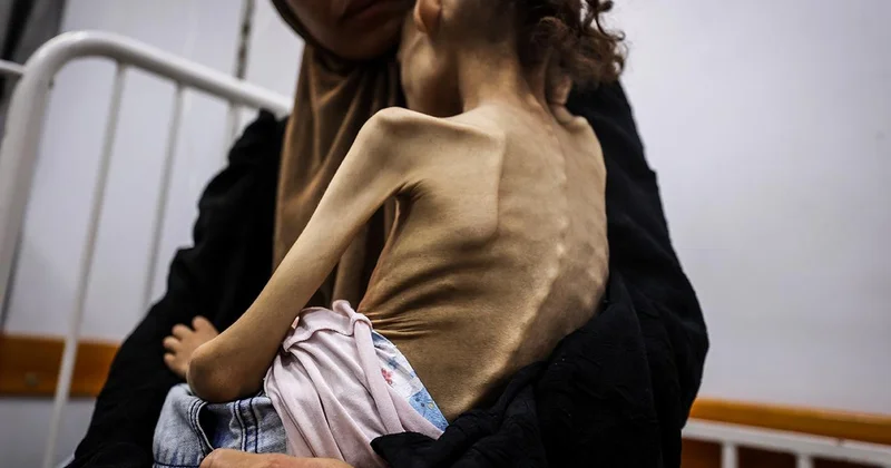 Gazze’de 9 yaşındaki Meryem, 25 kilodan 10 kiloya düştü