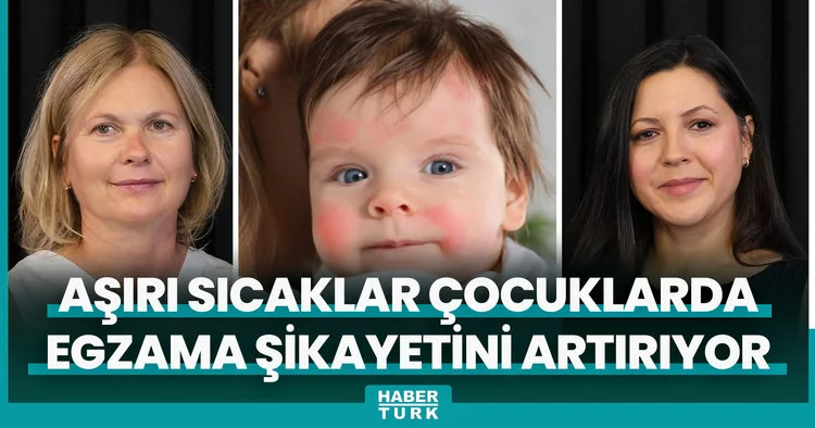 Aşırı sıcaklar çocuklarda egzama şikayetini artırıyor