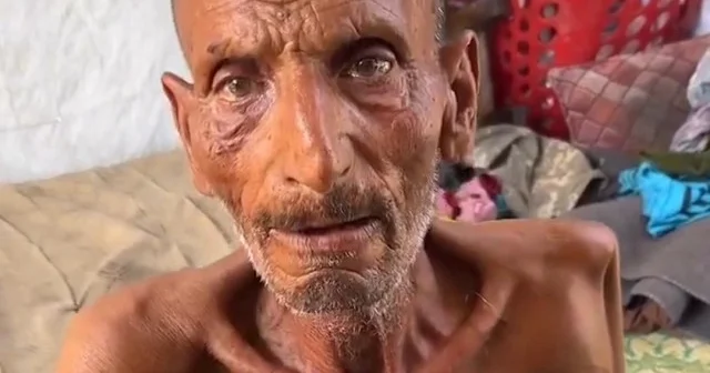 Açlıktan 40 kiloya düşen Gazzeli dünyaya seslendi: İnsan gibi yaşamak istiyoruz VİDEO İZLE