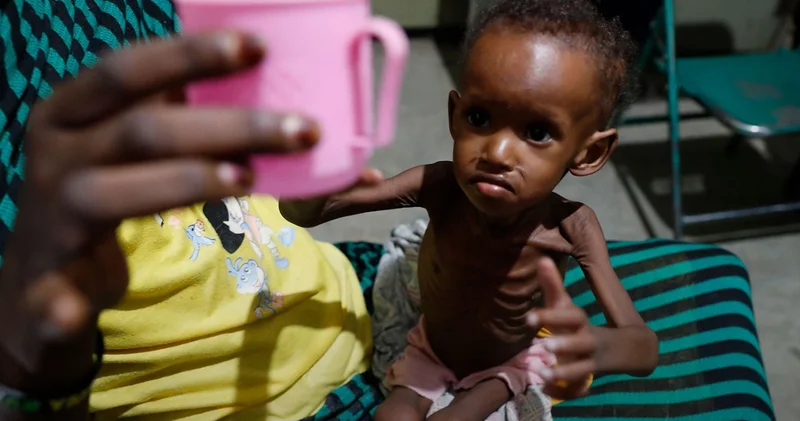 Afrika da insanlık utancı, 307 milyon insan açlıkla savaşıyor