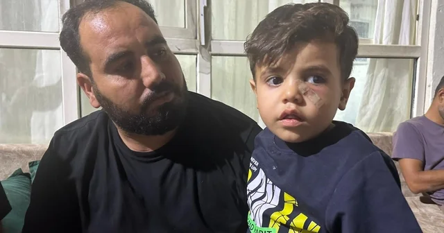 Yorgun mermi, 4 yaşındaki çocuğun gözünün altına isabet etti Şanlıurfa Haberleri