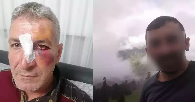 Dairesinin önüne hayvan dışkısı atan komşusundan, bu kez yüzüne kapı çarptığı için şikayetçi oldu
