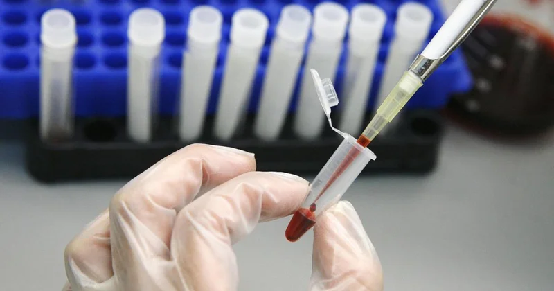 HIV tedavisinde tarihi adım: Virüs hücre içinde görünür hâle getirildi