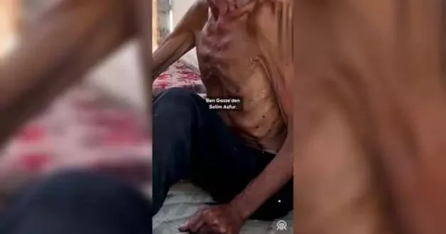 Gazze Şeridi nde 75 yaşındaki yaşlı adam, İsrail in dayattığı açlık nedeniyle 40 kiloya düştü