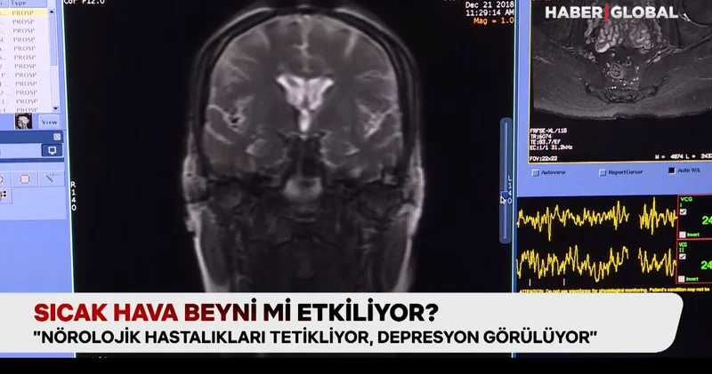 Sıcak hava beyni mi etkiliyor? Nörolojik hastalıkları tetikliyor