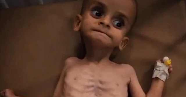 Gazzeli bebekler yetersiz beslenme nedeniyle ölümün eşiğinde VİDEO İZLE