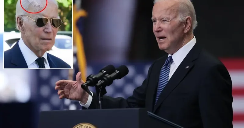 Biden, Cilt Kanseri Ameliyatı Geçirdi