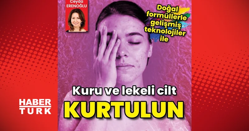 Kuru ve lekeli cildinizden doğal formüller ve gelişmiş teknolojiler yardımıyla kurtulun Sağlık Haberleri