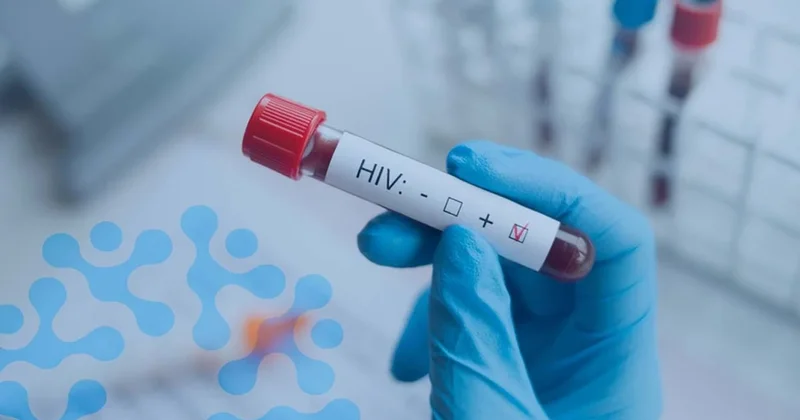 HIV tedavisinde devrim niteliğinde yöntem: Hepimizi şaşkına çevirdi Sözcü Gazetesi