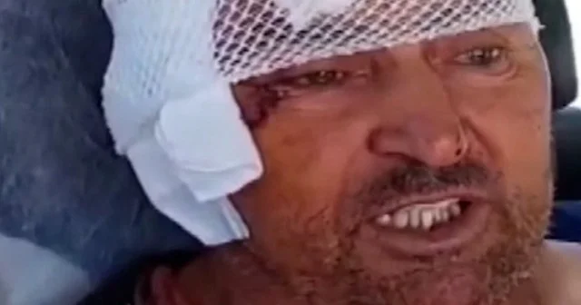 Antalya da aslan saldırısına uğrayan adam o anları anlattı VİDEO İZLE