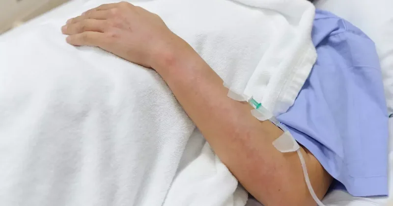 Chikungunya virüsü yayılıyor! Çin de vakalar 7 bini geçti, karantinalar başladı