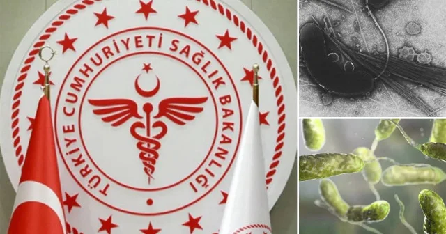 Türkiye de et yiyen bakteri vakası görüldü mü? Sağlık Bakanlığı ndan açıklama geldi Gündem Haberleri
