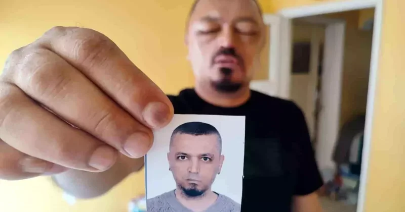 Şampuan Reaksiyonu: Gözde Sağlık Sorunu Yaşadı