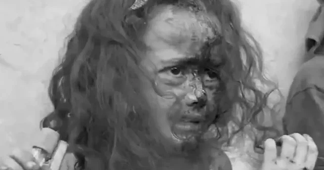 Gazze’de hava saldırısında onlarca Filistinli katledildi: Yüzü kanlar içinde kalan minik kızın ağlayışı yürekleri sızlattı VİDEO İZLE