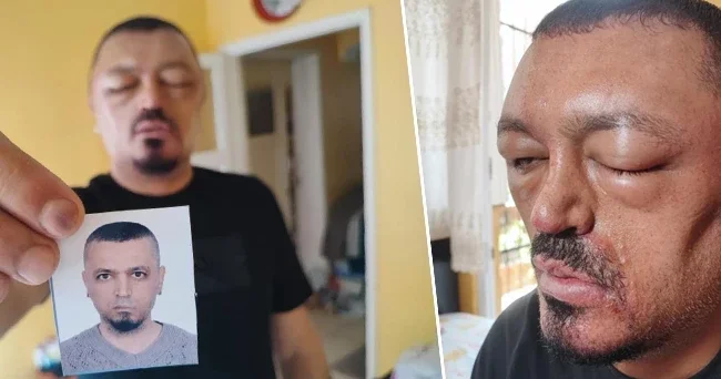 Berberi önerdi internetten satın aldı! 48 saat sonra hayatı kabusa döndü Gözlerimi kaybedeceğim diye çok korktum