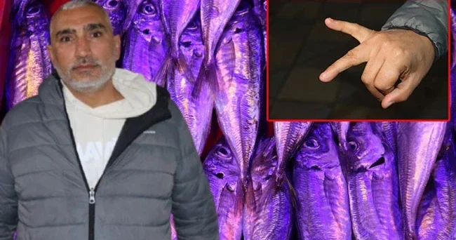 Balıkçıyla kavga eden müşteri çuprayla dövüldü, eli kırıldı!