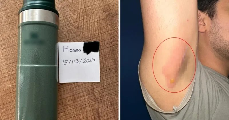 Dünyaca ünlü markanın termosu, genç adamı hastanelik etti