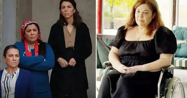 Ünlü oyuncu Eylem Tanrıver in hayatı estetik ameliyatı sonrası kabusa döndü: Felç kaldı, vücudunda yaralar açıldı, enfeksiyon kaptı Aktüel Haberleri