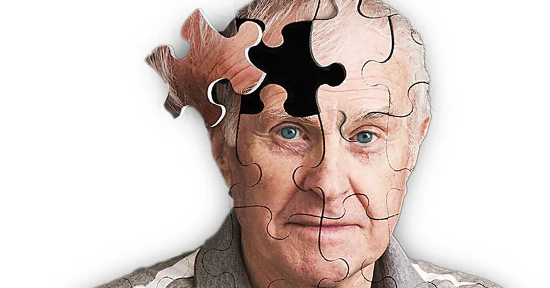 İğne, Hap ve Umut: Alzheimer’a karşı son cephe Sözcü Gazetesi