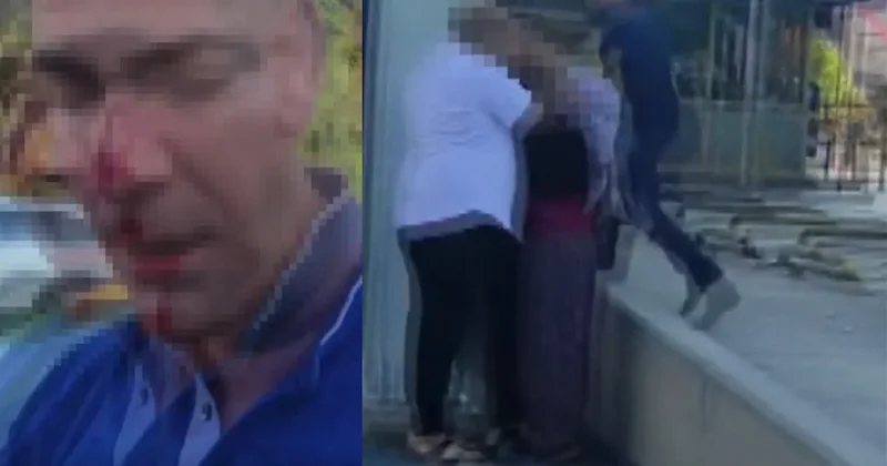 Marmaray dan sonra bu kez Ankara! Eşinin ve çocuklarının yanında dövüp bu hale getirdiler Sözcü Gazetesi