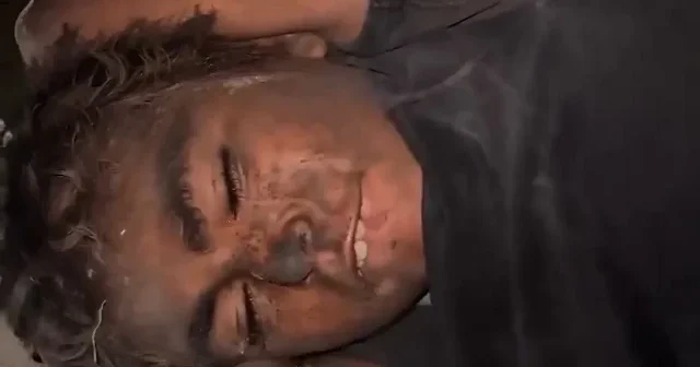 Gazze de acı acı inleyen otizmli kızın görüntüleri izleyenleri kahretti VİDEO İZLE