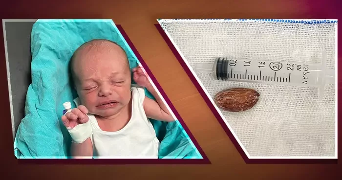 16 günlük bebeğin nefesi şekerle kesildi! 4 yaşındaki abisinin tadı güzel dediği badem şekeri boğulma tehlikesine yol açtı: Aileler bu durumda ne yapmalıdır? Uzmanlardan uyarı...