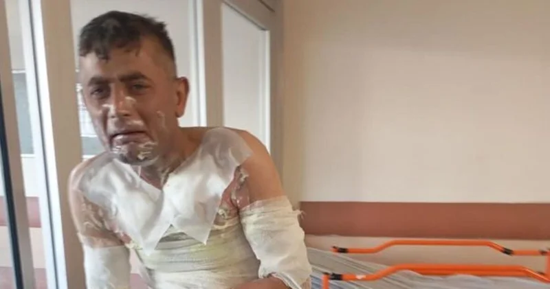 Son dakika: Gaziosmanpaşa da engelli vatandaş dehşeti yaşadı: Telefonunu çaldı, şikayet edince benzin döküp yaktı Son dakika haberleri