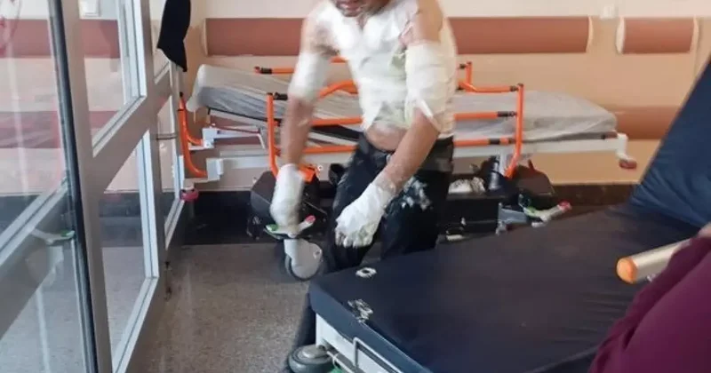 Engelli vatandaşın telefonunu çaldı sonra da dehşeti yaşattı!