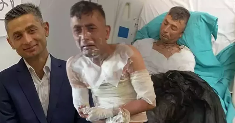 Engelli vatandaşın üzerine benzin dökerek yaktı: Olayın her detay kan dondurdu...